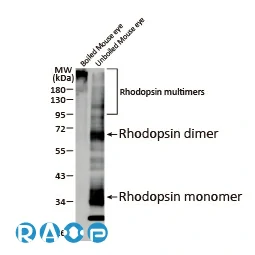 Rhodopsin antibody [HL2668]